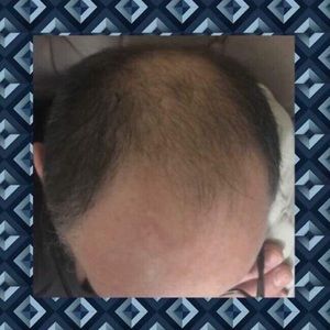 Sorduse huile capillaire pour cheveux